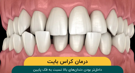 کراس-بایت